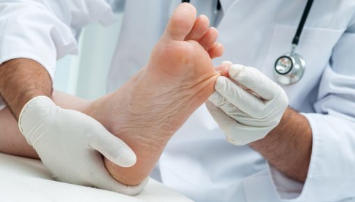 Foto von Fußpilz-Diagnose beim Hautarzt