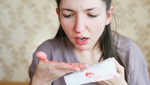 Foto von junger Frau mit Nasenbluten und Taschentuch