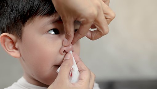 Foto von kleinem Jungen mit Nasenbluten