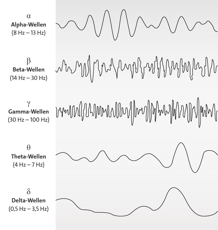 Die Grafik zeigt die unterschiedlichen typischen Wellenmuster eines EEGs in Abhängigkeit von der Hirnaktivität