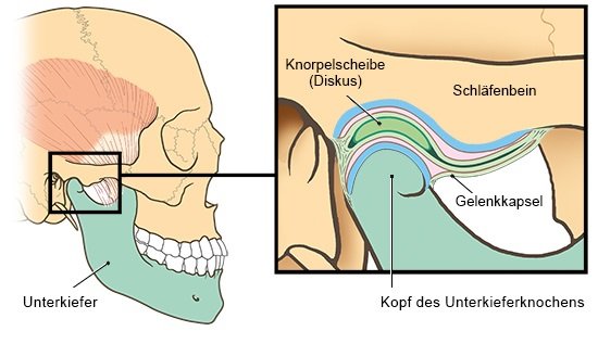 Die vereinfachte anatomische Grafik zeigt das Kiefergelenk am Schädel sowie im Detail (rechts).