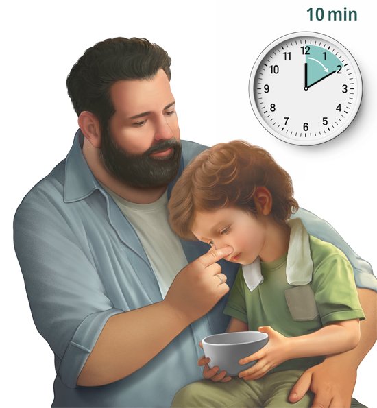 Grafik: Nasenbluten bei einem Kind stoppen