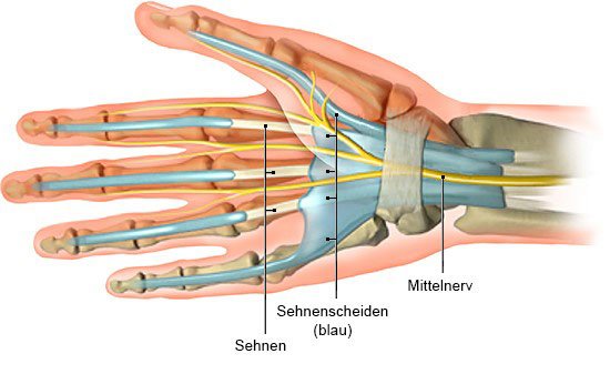 Die anatomische Grafik zeigt eine Handinnenseite mit Sehnen und Sehnenscheiden.