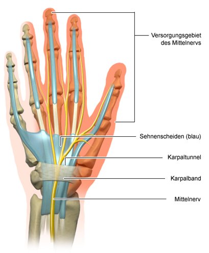 Die anatomische Grafik der Hand zeigt den Karpaltunnel und die Nerven der Handinnenseite.