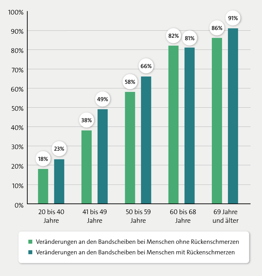 Das Säulendiagramm zeigt Veränderungen an den Bandscheiben bei Menschen mit im Vergleich zu ohne Rückenschmerzen in verschiedenen Altersgruppen in Prozent.