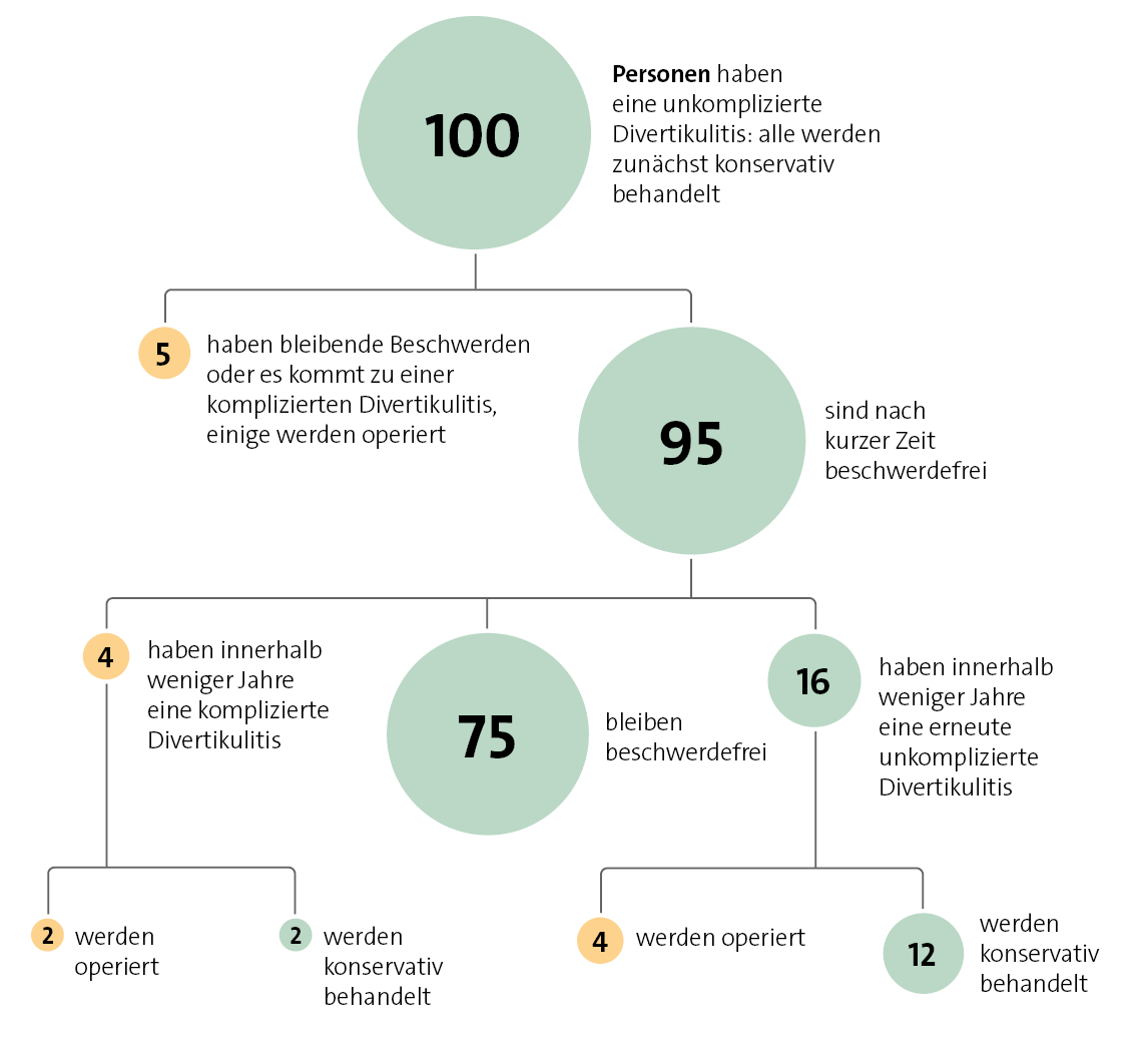 Die Grafik zeigt die vereinfachte Darstellung des Krankheitsverlaufs bei 100 Personen mit unkomplizierter Divertikulitis