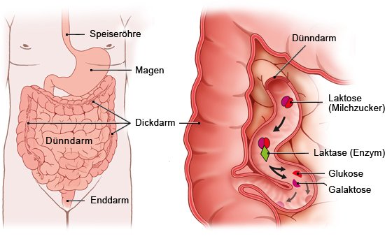 Diese Grafik zeigt links die Anatomie des Verdauungssystems und rechts, wie das Enzym Laktase den Milchzucker im Dünndarm spaltet.