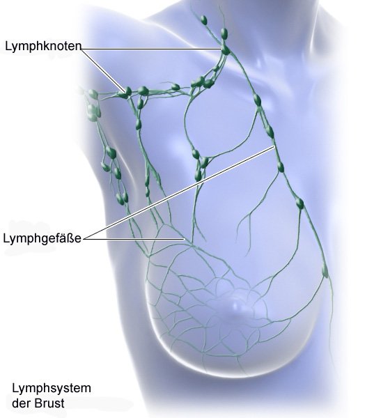 Die Grafik zeigt das Lymphsystem der Brust mit Lymphknoten und Lymphgefäßen.