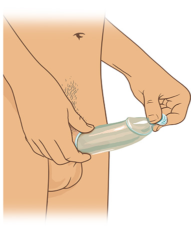 Die Grafik zeigt, wie das Kondom über den steifen Penis gerollt wird.