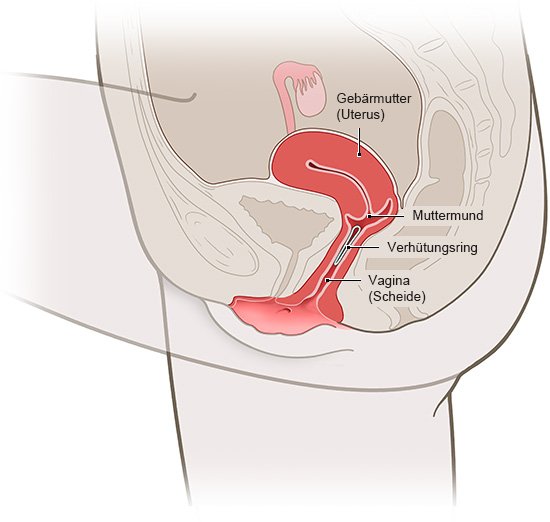 Die Grafik zeigt die Lage des Verhütungsrings in der Vagina.