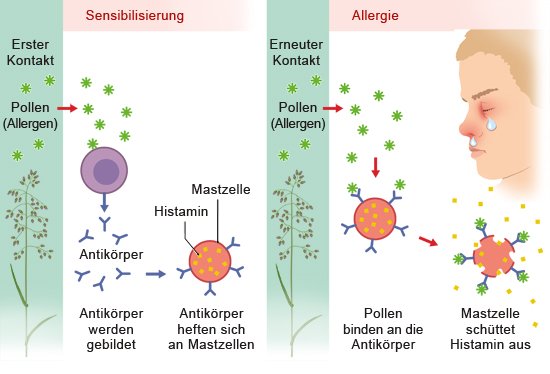 Grafik: Entwicklung einer Allergie - wie im Text beschrieben