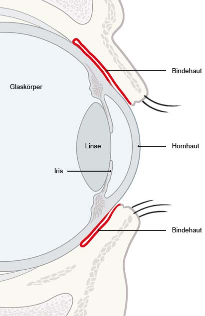 Grafik: Seitliche Ansicht des Auges mit Bindehaut (rot) - wie im Text beschrieben