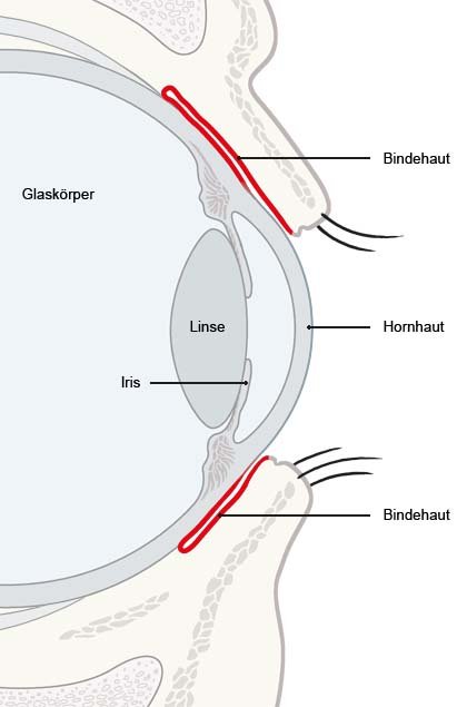 Grafik: Seitliche Ansicht des Auges mit Bindehaut (rot) - wie im Text beschrieben