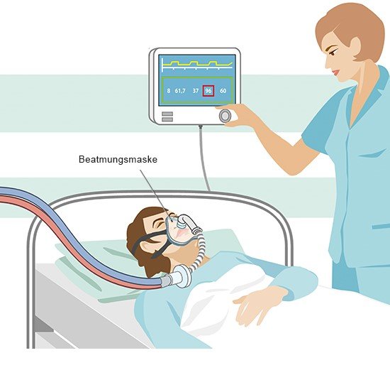 Grafik: Beatmung mit Maske