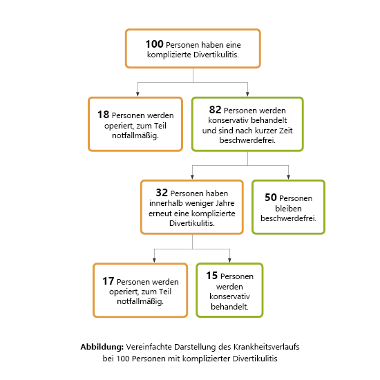 Grafik: Vereinfachte Darstellung des Krankheitsverlaufs von 100 Personen mit komplizierter Divertikulitis