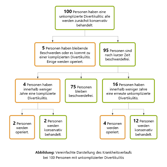Grafik: Vereinfachte Darstellung des Krankheitsverlaufs bei 100 Personen mit unkomplizierter Divertikulitis