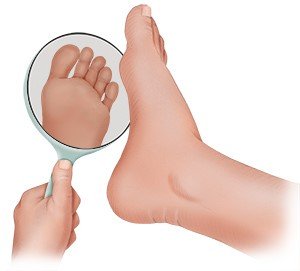 Grafik: Fußkontrolle mit Handspiegel