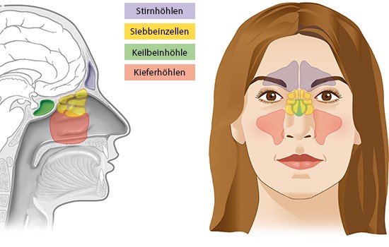 Grafik: Lage der Nasennebenhöhlen - wie im Text beschrieben