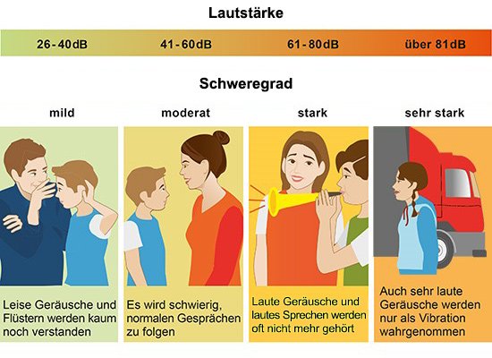 Grafik: Verschiedene Grade von Schwerhörigkeit