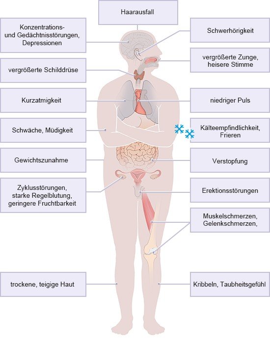 Grafik: Mögliche Symptome einer Schilddrüsenunterfunktion