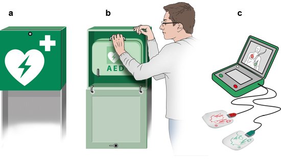 Grafik: Funktion eines Defibrillators: a) Beispiel Aufbewahrungsort, b) Entnahme des AED-Kastens, c) AED aufgeklappt mit Elektroden-Aufklebern
