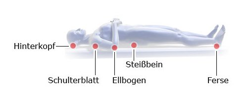 Grafik: Druckgeschwüre: typische Entstehungsorte beim Liegen, seitlichGrafik: Druckgeschwüre: typische Entstehungsorte beim Liegen, Rückenlage