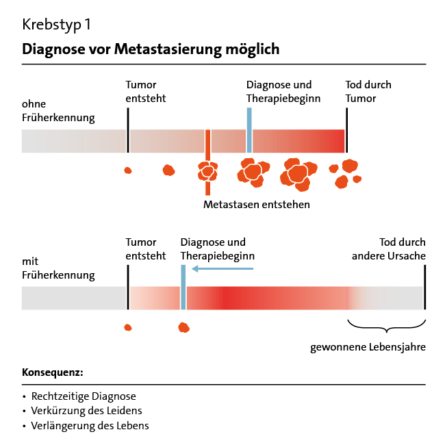 Grafik: Früherkennung Krebstyp 1