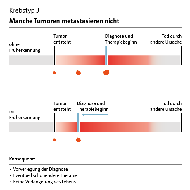 Grafik: Früherkennung Krebstyp 3