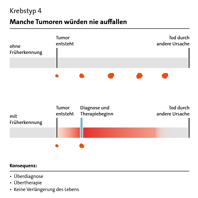 Grafik: Früherkennung Krebstyp 4