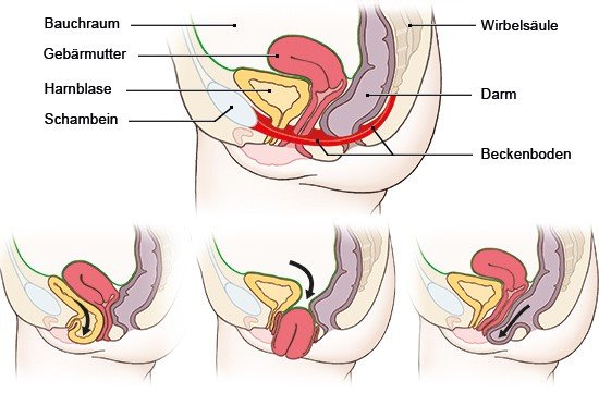 Im scheideneingang geschwulst Bartholinitis: Symptome,