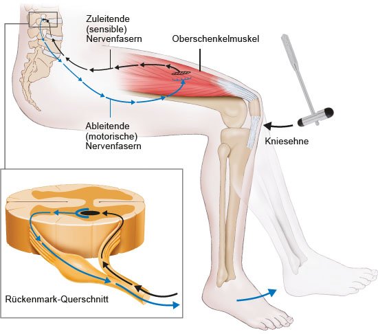Grafik: Die Prüfung der Reflexe ist Teil einer neurologischen Untersuchung - wie im Text beschrieben