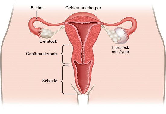 Gebärmutter lange krank zyste op wie Wie lange