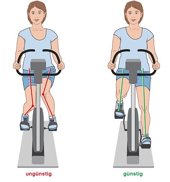 Grafik: Ungünstige und günstige Beinhaltung beim Radfahren