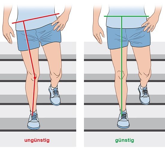 Grafik: ungünstige und günstige Beinhaltung beim Treppensteigen