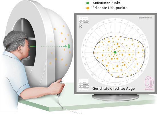Gesichtsfeldmessung Mit Oder Ohne Brille www.gesundheitsinformation.de