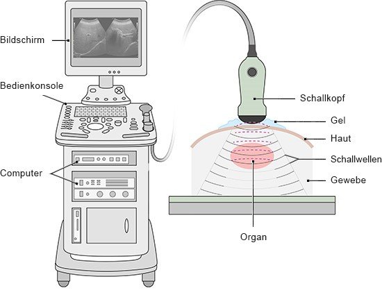 Die Grafik zeigt ein Ultraschallgerät mit Bildschirm und Schallkopf sowie dessen Funktionsweise.