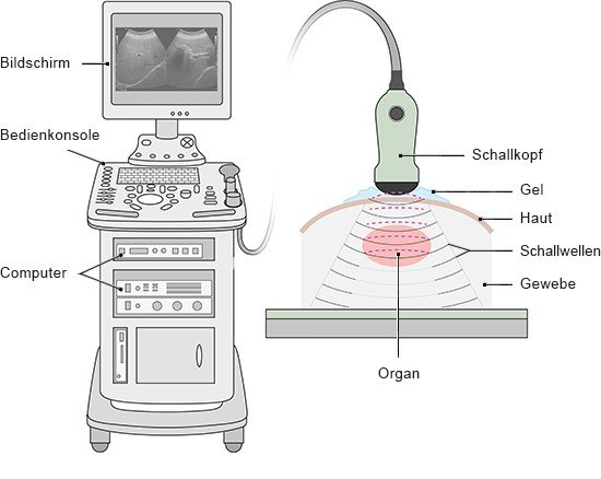 Wie funktioniert eine Ultraschalluntersuchung?