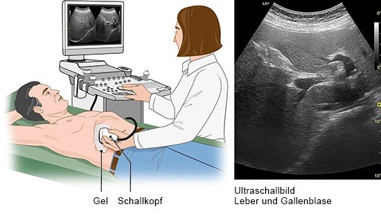 Grafik: Beim Ultraschall des Bauches kann man z. B. die Leber erkennen
