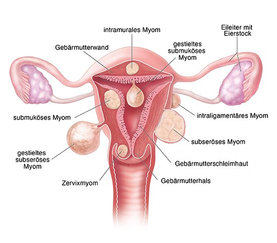 Trotz gebärmutterentfernung periode Ultraschall gebÃ¤rmutter