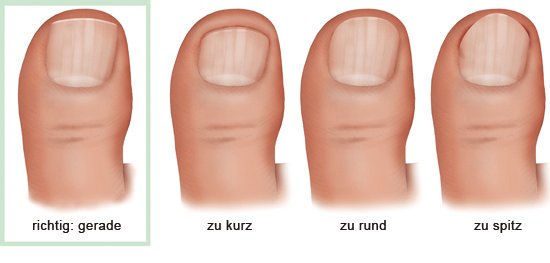 Wächst nach fingernagel nicht ᐅ Wächst