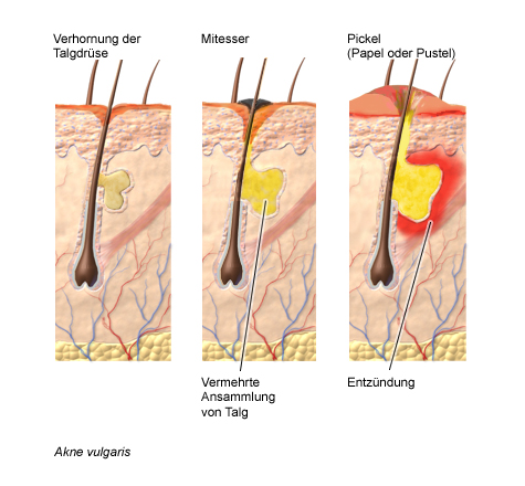 dermatologist Meaning in the Cambridge English Dictionary