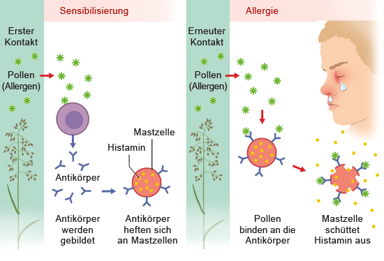 Wie Lange Hält Eine Allergische Reaktion An www.gesundheitsinformation.de