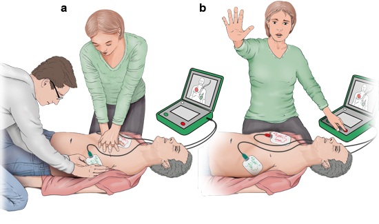 Wie Benutzt Man Im Notfall Einen Externen Defibrillator Aed