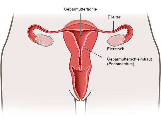 Wie entsteht Endometriose? - Endometriose - gesundheitsinformation.de