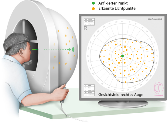 Augenuntersuchung bei diabetes